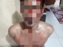 Mencuri Sapi, Pelaku Diamuk Masa Sampai Babak Belur