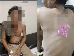 Pria Dibusur saat Melintas di WR Supratman, Polresta Palu Bergerak Cepat Usut Pelaku